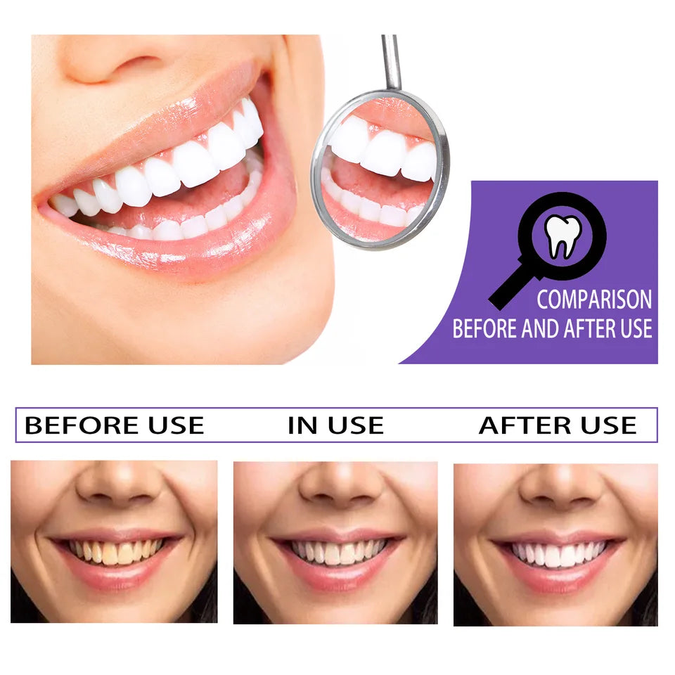 Remove yellow tooth stains, unpleasant odor, fresh mouth, fresh breath, purple toothpaste
